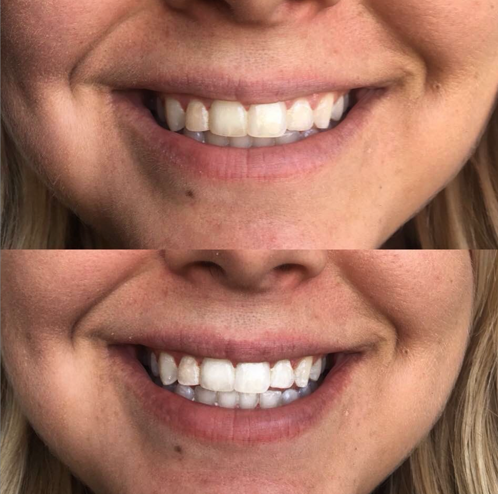 cozy smile kit